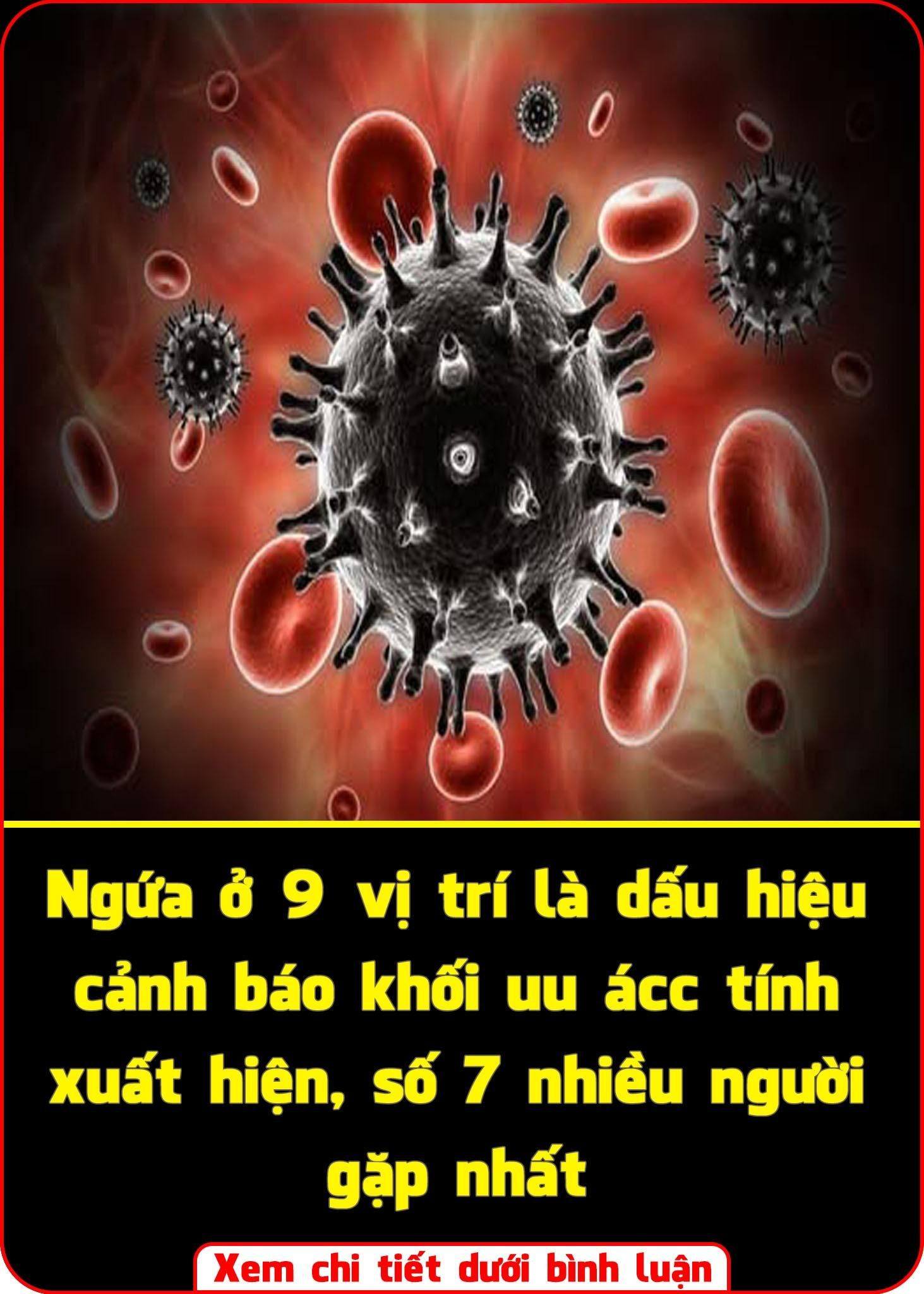Ng ứ a ở 9 vị trí là dấu hiệu cảnh báo khối uu ácc tính xuất hiện, số 7 nhiều người gặp nhất