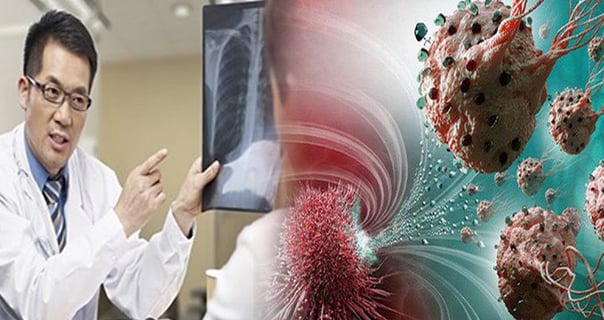 UT giai đoạn cuối sẽ có 4 dấu hiệu lạ, đi bệnh viện khám càng sớm càng tốt