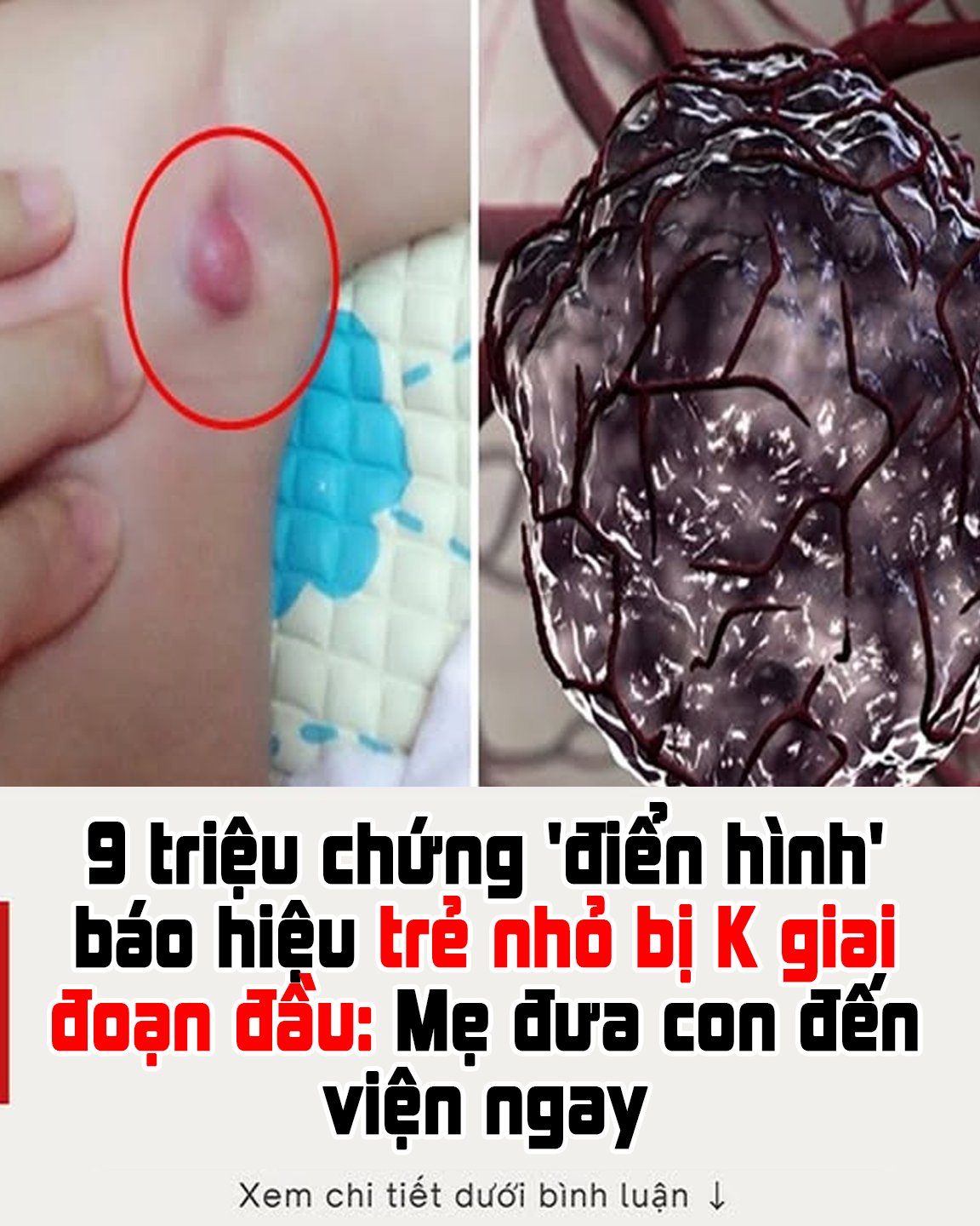 9 triệu chứng ‘điển hình’ báo hiệu trẻ nhỏ bị K giai đoạn đầu: Mẹ đưa con đến viện ngay