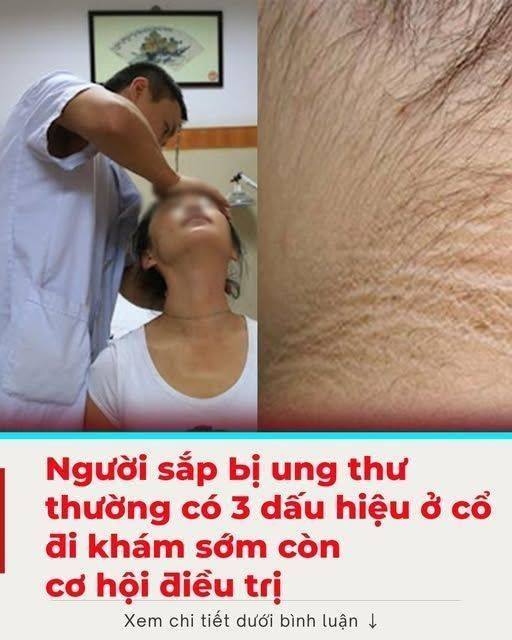 Người sắp bị ung thư thường có 3 dấu hiệu ở cổ, đi khám sớm còn cơ hội điều trị